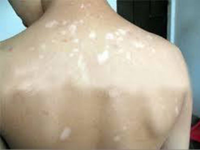 ���粻���ƿ����Լ�Ȭ����