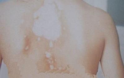 ���������Ӧ��ע��������ʲô